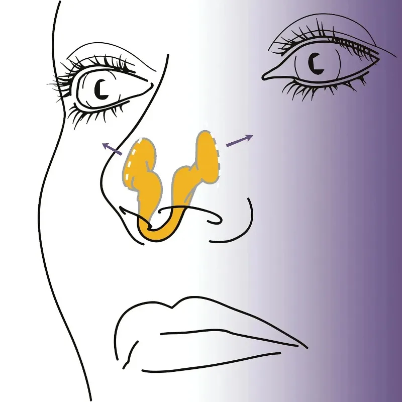 Airflow Dilator 2-Pack – Soft Silicone Anti-Snoring Nose Clip - Image 4