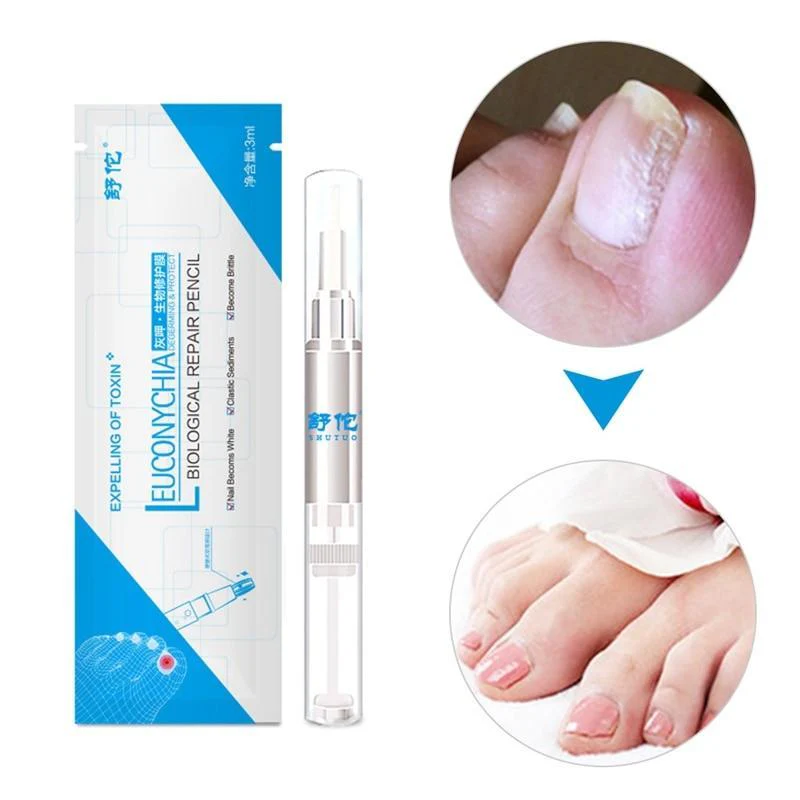 Anti-Fungal Natural Nail Treatment Pen - Image 4