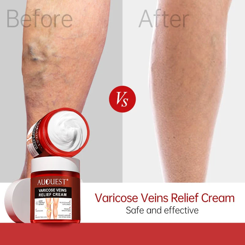 AUQUEST™ Varicose Veins Relief Cream