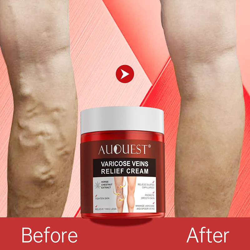 AUQUEST™ Varicose Veins Relief Cream - Image 3