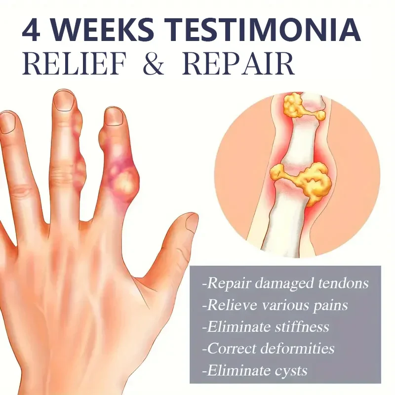 Bee Venom Joint Lotion — Hypoallergenic & Fast-Absorbing Joint Recovery Care - Image 3