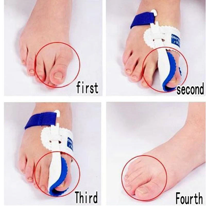 Footpro™ Bunion Corrector (1 Pair ) - Image 4