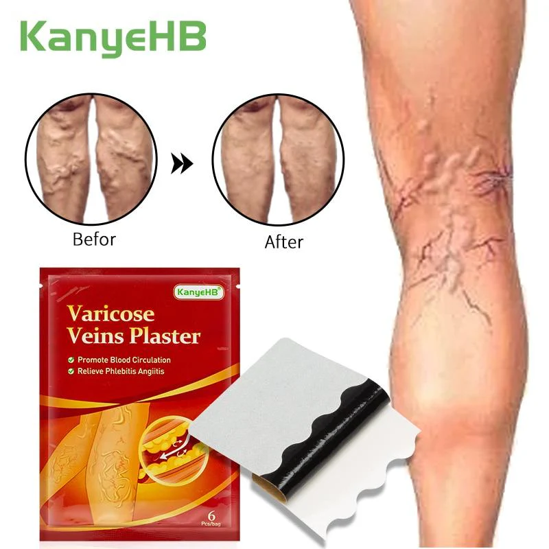 Leg Varicose Herbal Medicine Healing Patch (6pcs) - Image 2