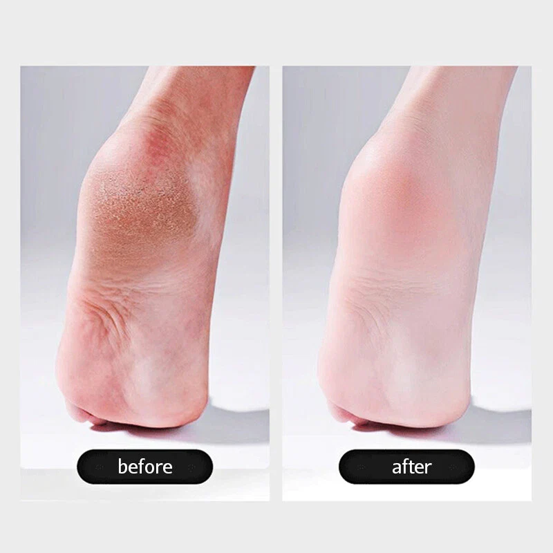Double-Sided (Thick and Fine Grits) Design Ergonomic Foot File & Callus Remover - Image 15