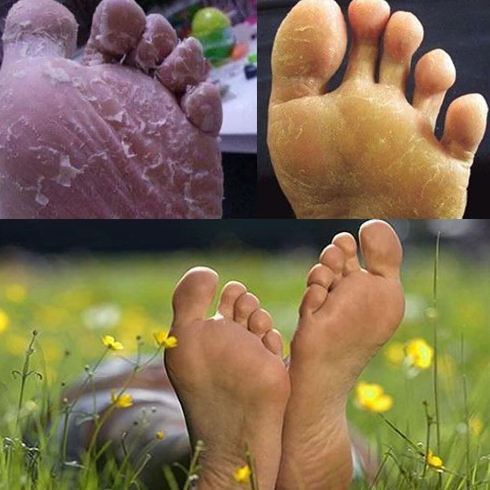 Antifungal Detox Japanese Foot Soak Treatment (6pcs) - Image 3