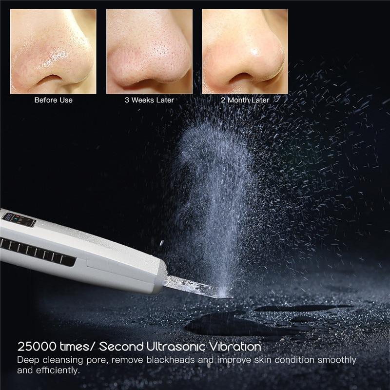 ScrubTech™   Ultrasonic Skin Facial Cleanser - Image 2