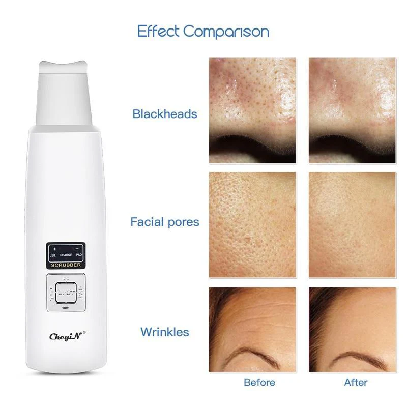 ScrubTech™   Ultrasonic Skin Facial Cleanser - Image 7
