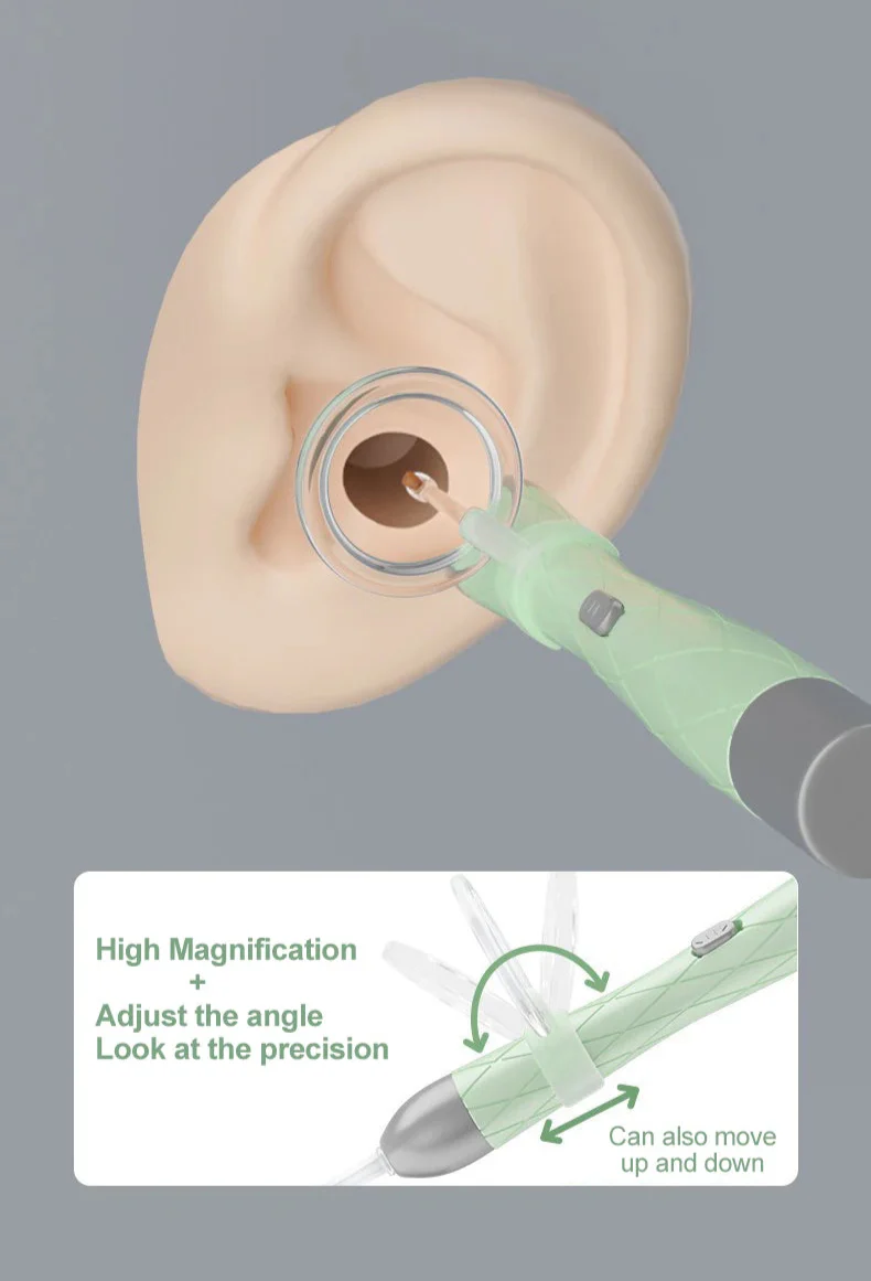 Extra-Safe Family Ear Cleaning Kit with LED Light, Magnifier, Tweezers & Multiple Spoon Heads - Image 11