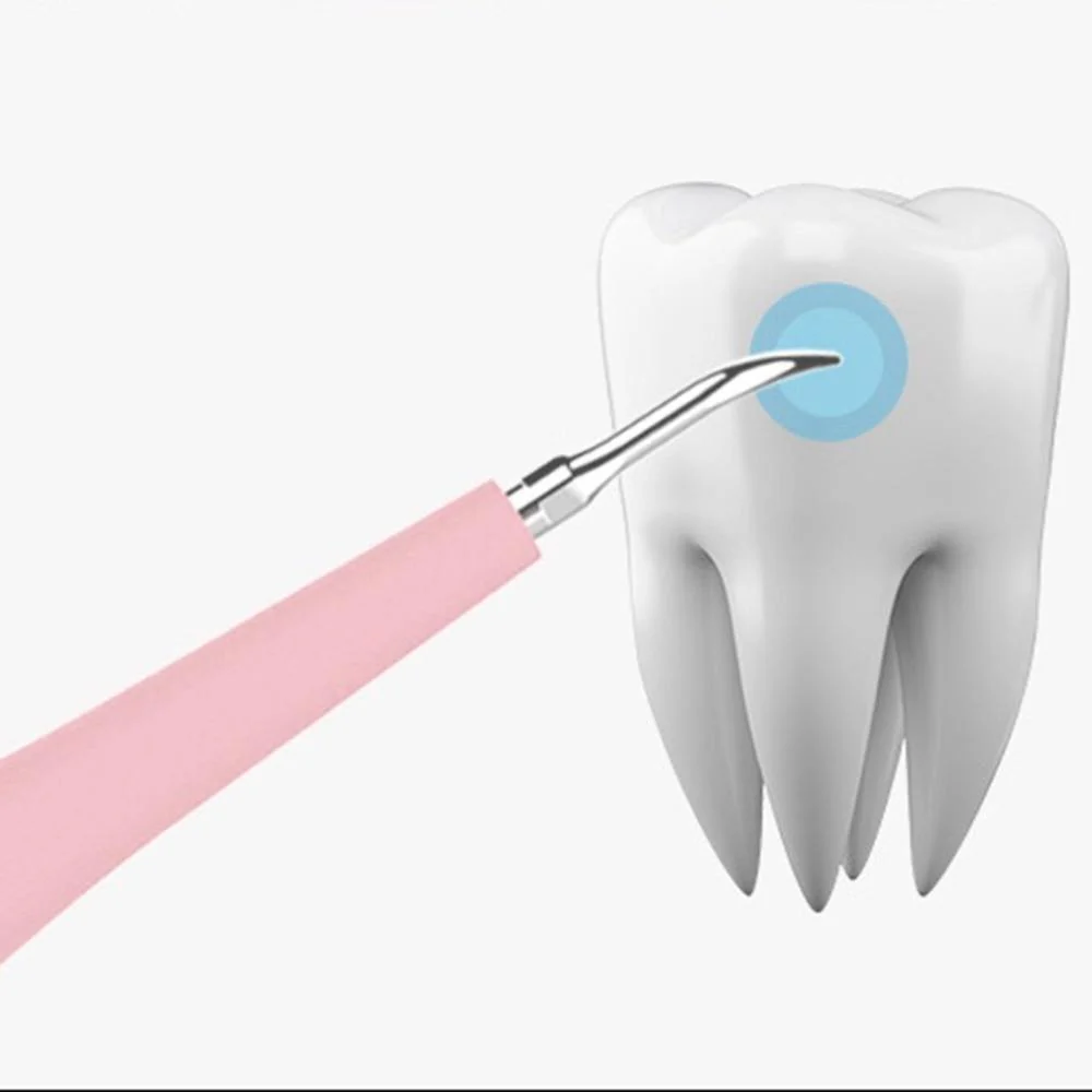 Electric Dental Plaque Remover - Image 3