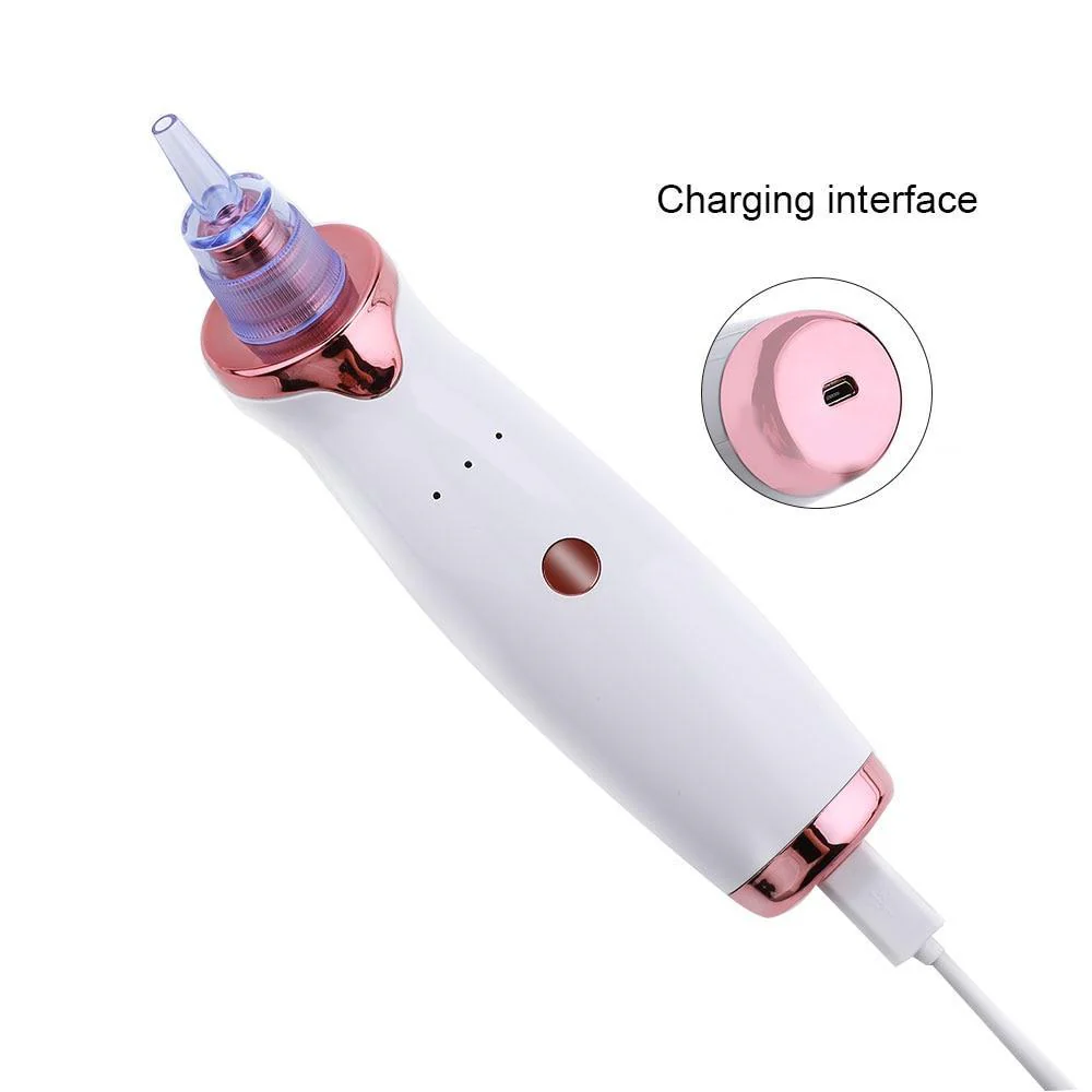 Blackhead Vacuum Facial Pore Cleaner (USB Rechargeable) - Image 4