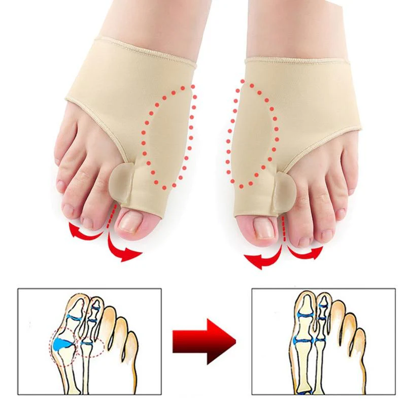 Cozy Bunion Correction Socks (2pcs) - Image 3