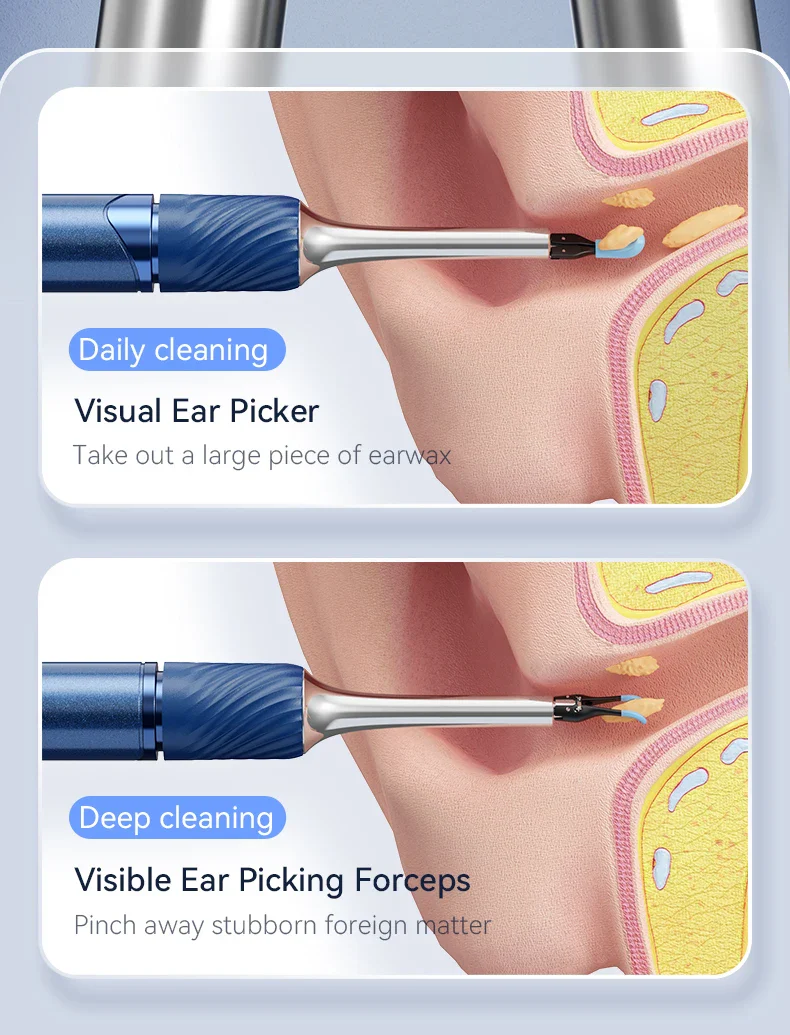 WiFi 3-in-1 Ear Otoscope- HD Camera 360° Precision Robotic Tweezer & Gentle Silicone Earpick - Image 12