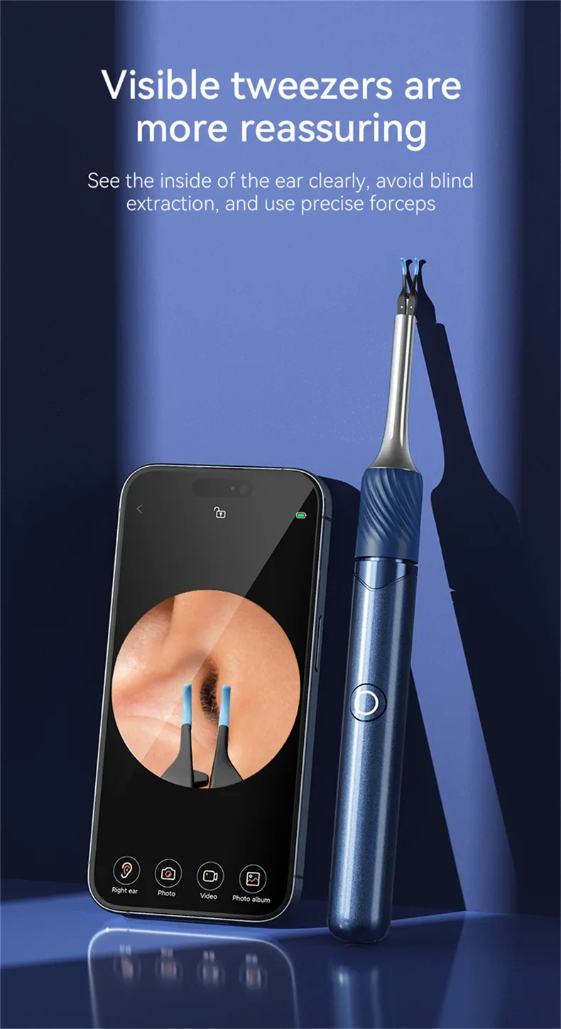 WiFi 3-in-1 Ear Otoscope- HD Camera 360° Precision Robotic Tweezer & Gentle Silicone Earpick - Image 13