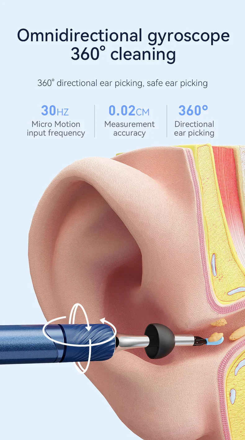 WiFi 3-in-1 Ear Otoscope- HD Camera 360° Precision Robotic Tweezer & Gentle Silicone Earpick - Image 17