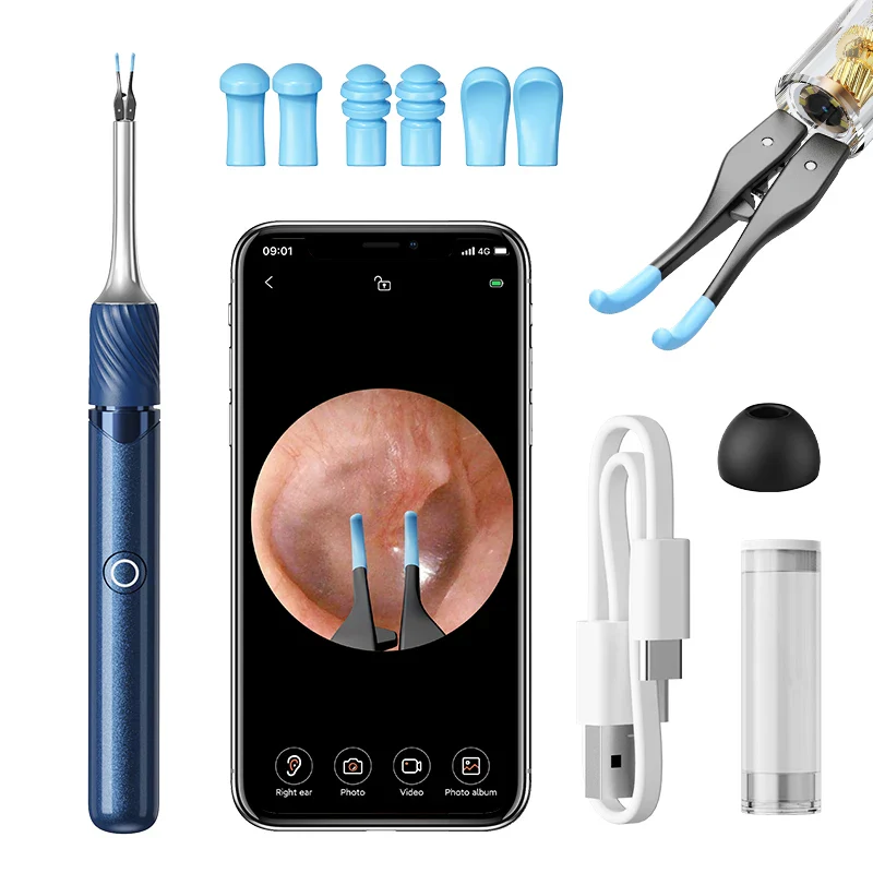 WiFi 3-in-1 Ear Otoscope- HD Camera 360° Precision Robotic Tweezer & Gentle Silicone Earpick - Image 26