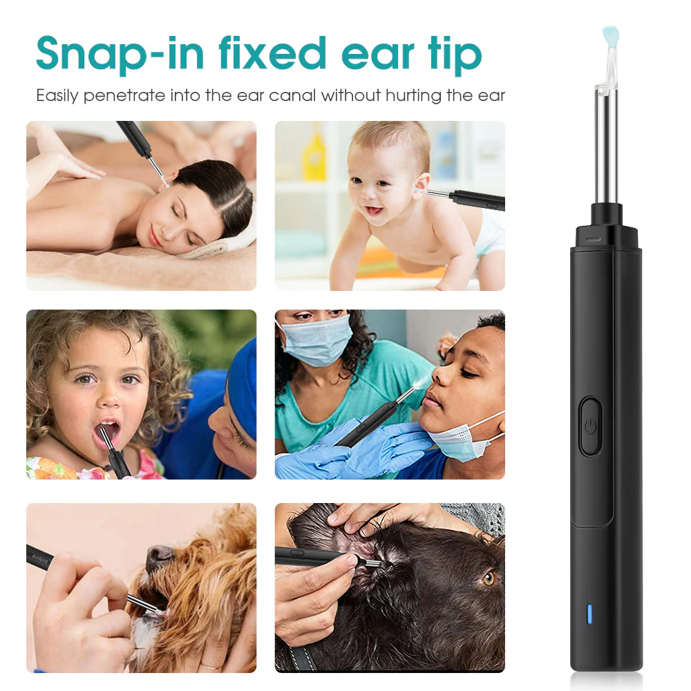 Rechargeable Wireless WiFi Ear Pick Otoscope Camera - Image 3