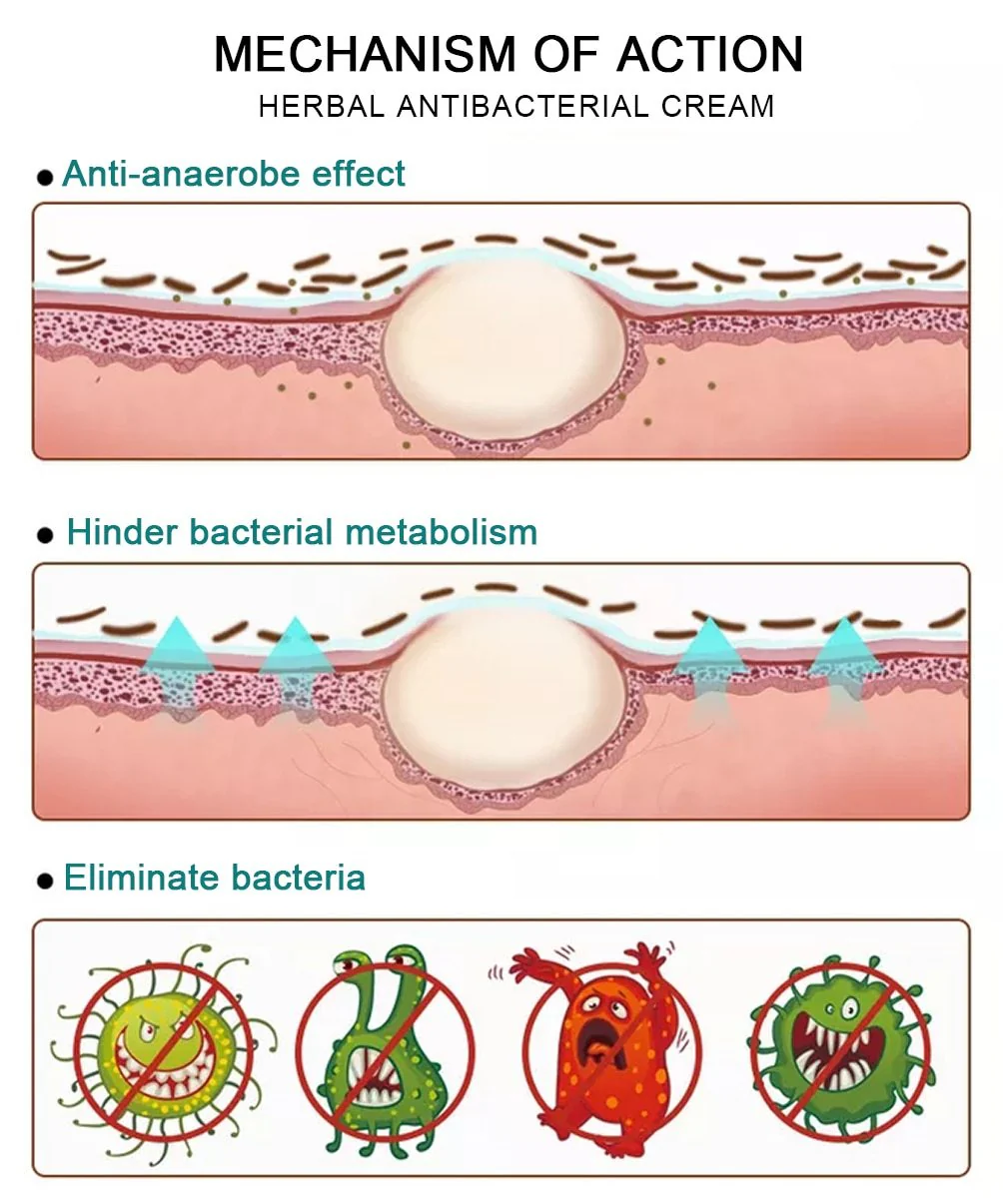 All-Natural Asian Herbal Eczema Treatment Cream - Image 3