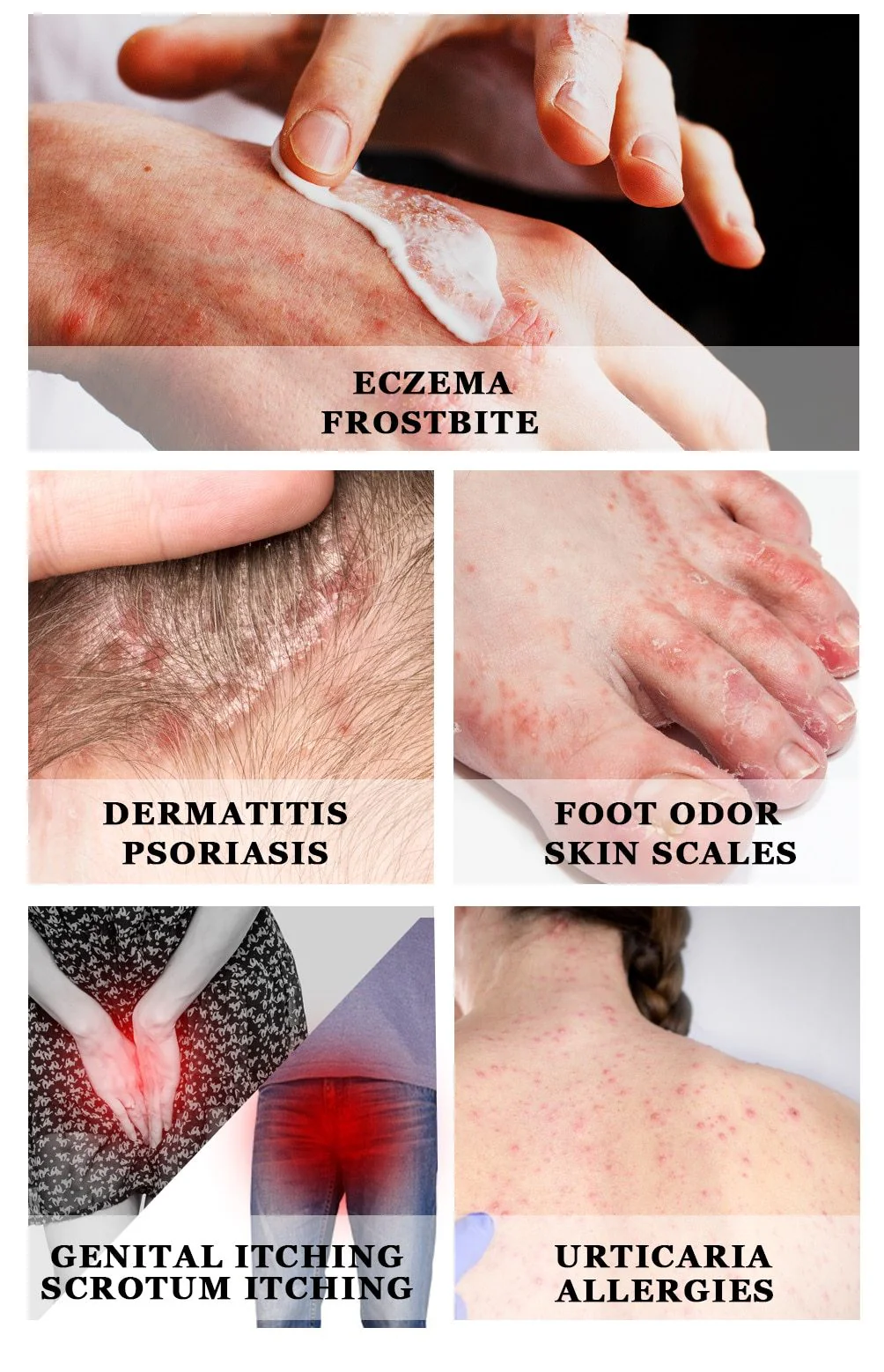 All-Natural Asian Herbal Eczema Treatment Cream - Image 6